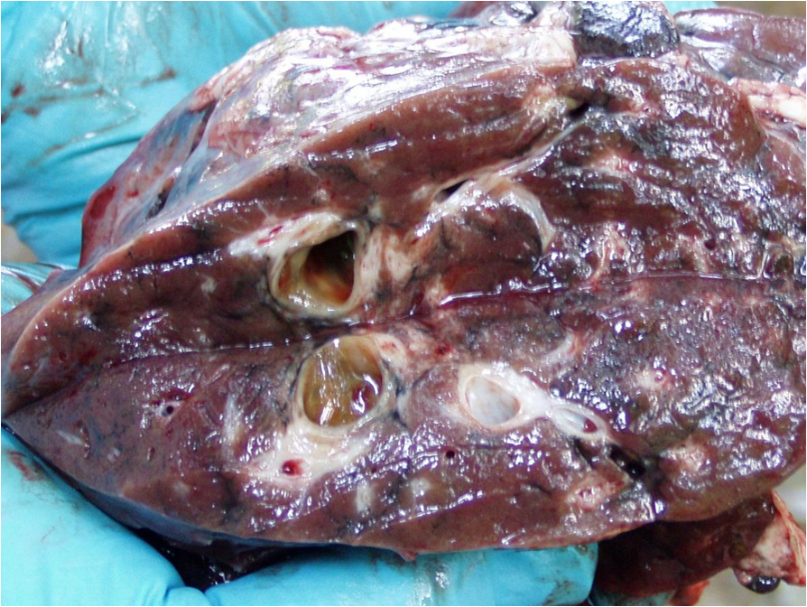 Liver of fallow deer infected with Fascioloides magna.