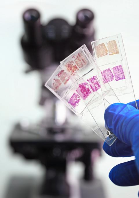 holding histo slides