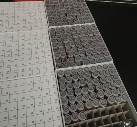 Research project blood samples that need prep and organization for testing and/or storage in our freezer sample archive.