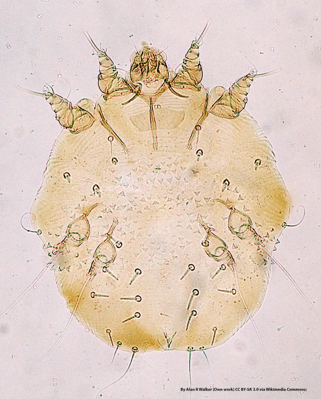 Sarcoptes-scabiei under microscope