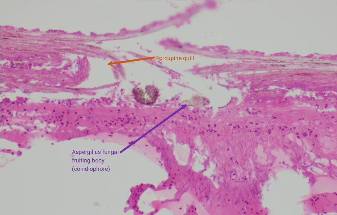 histopath slide with notations