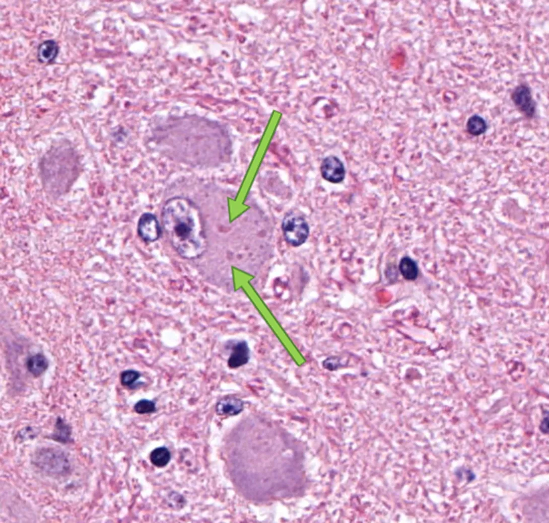 Rabies inclusions (Negri bodies)in the brain of a white-tailed deer