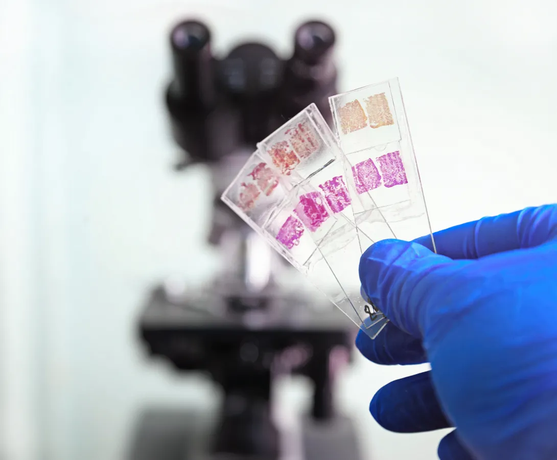 holding histo slides