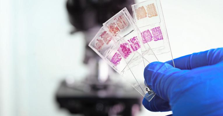 holding histo slides