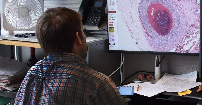 Dr. Hitchener reviewing a histopathology slide on computer monitor