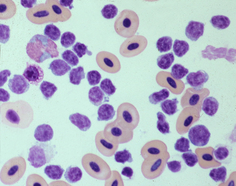 Avian leukocytes in a blood smear under scope