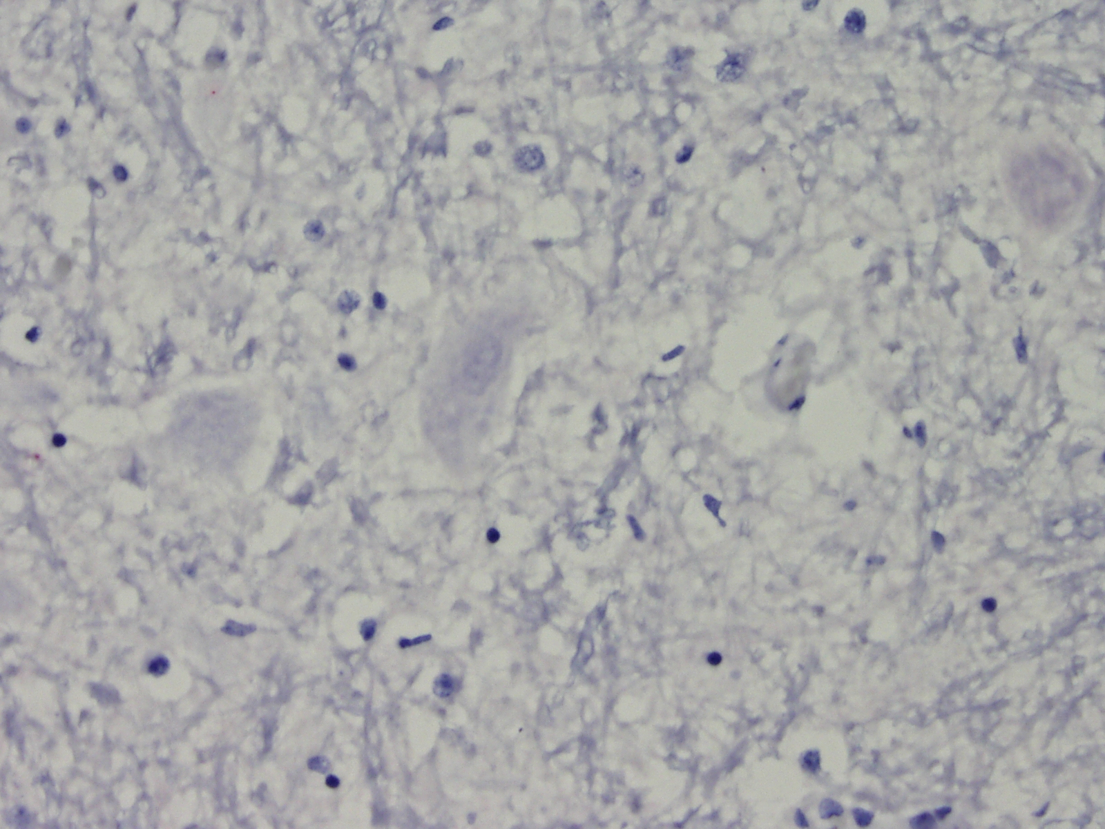 Histo slide of negative neuron test result