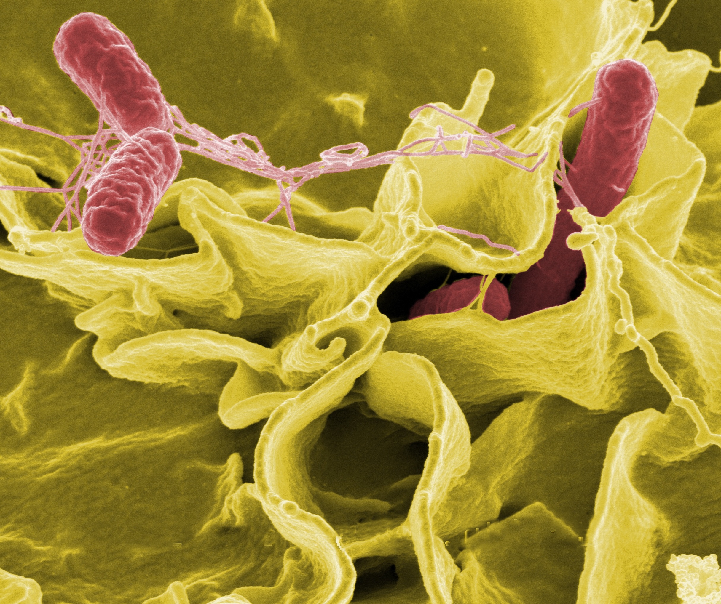 Salmonella microscopic image