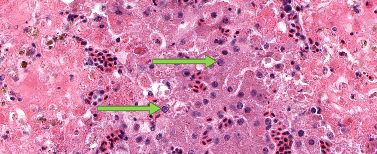 Example of herpesvirus in the liver of a peregrine falcon