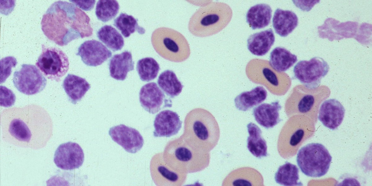 Avian leukocytes in a blood smear under scope